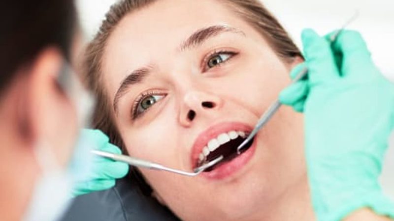 Відбілювання зубів проти зубних вінірів