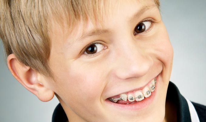 Детская стоматология в Киеве: как исправить прикус у ребенка