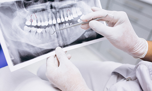 Как часто можно делать рентген зубов?